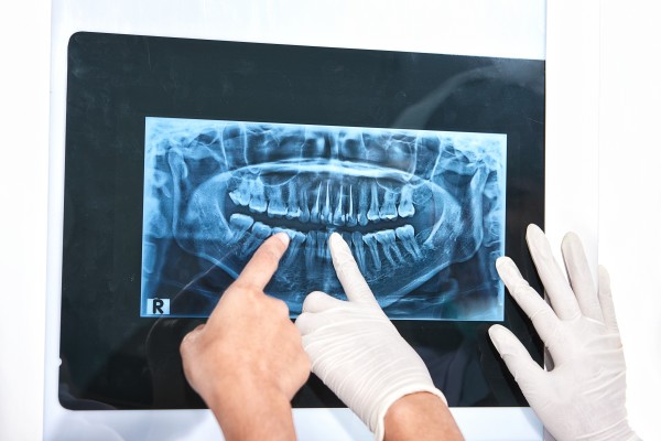 radiologie dentara bucuresti, clinica drm bucuresti